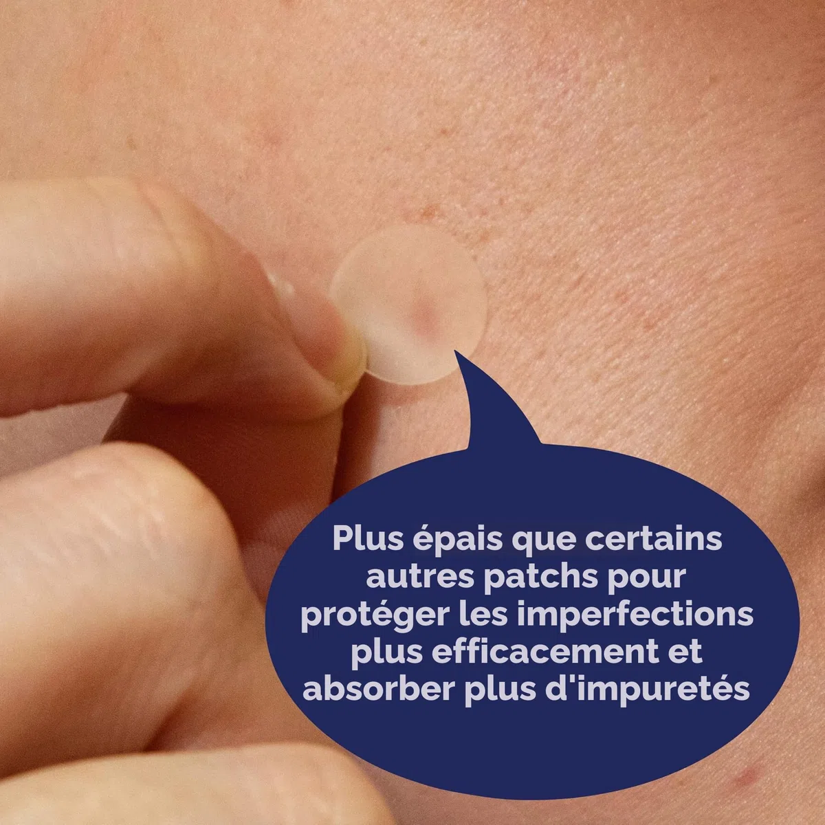 PanOxyl PM Lot de 40 patchs ronds nocturnes avec technologie avancée de guérison hydrocolloïde sans parfum